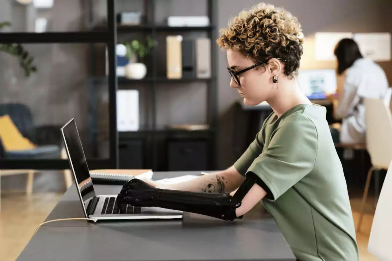Woman with prosthetic arm typing on laptop.